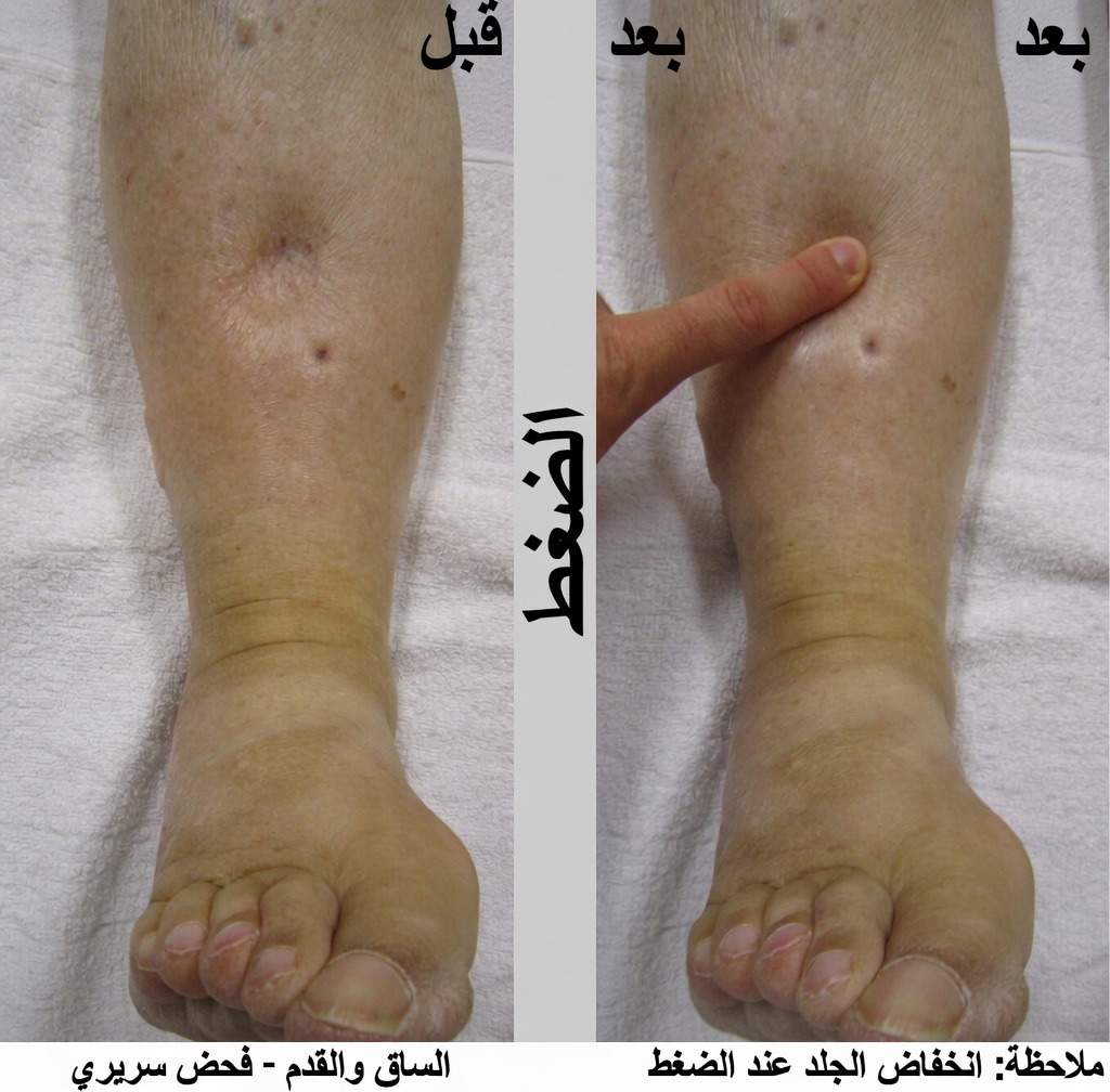 ما هي الآثار الجانبية الاثنا عشر الأكثر شيوعًا لأملوديبين والعادات اليومية التي يمكن أن تُحدث فرقًا؟