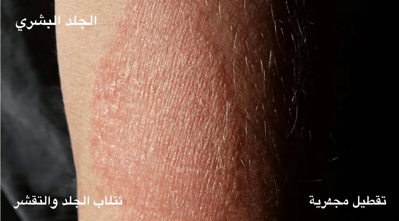 13 علامة مبكرة على الفشل الكلوي قد تكون تتجاهلها كل يوم في حياتك المزدحمة