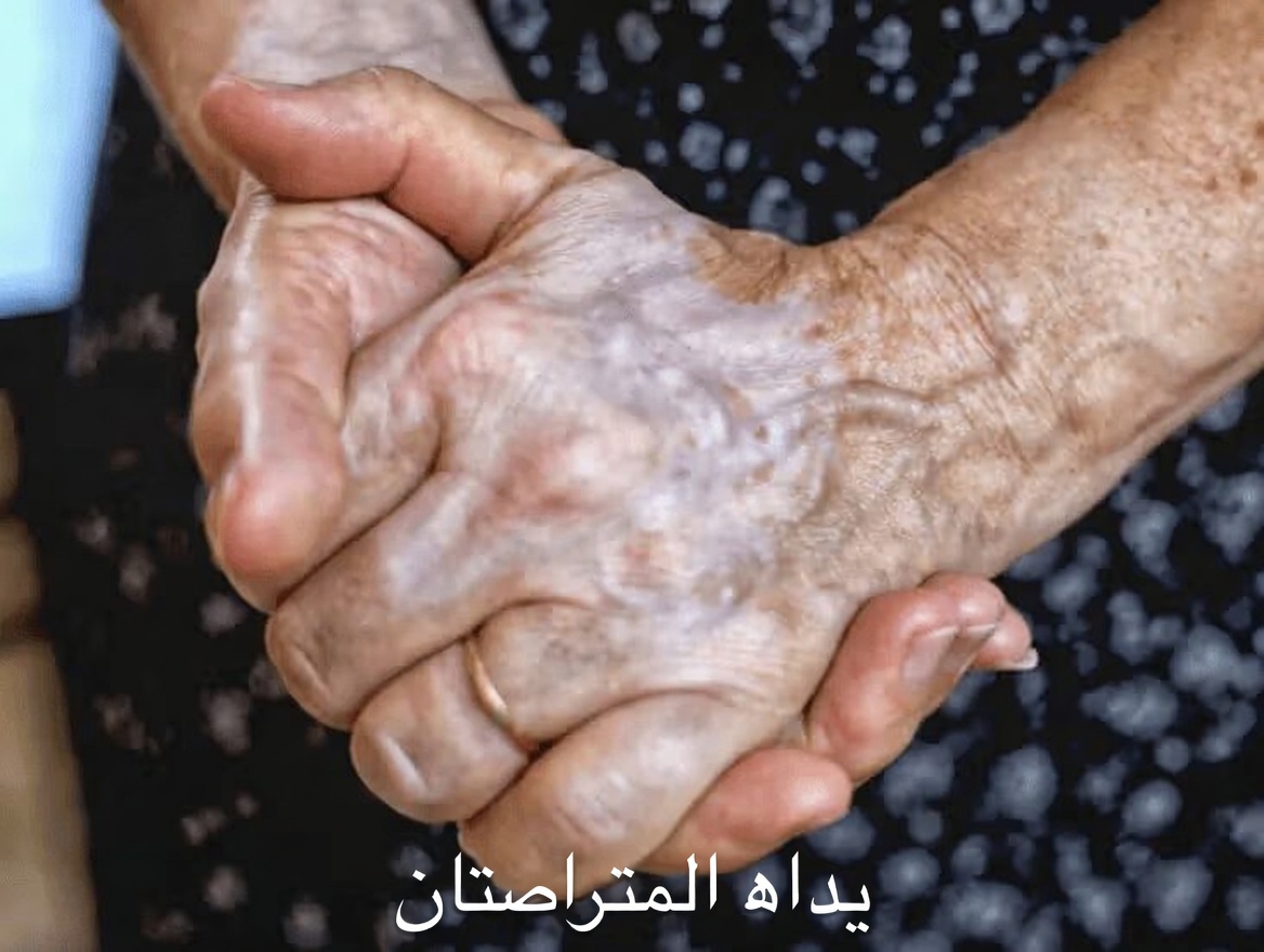 لماذا أصبحت أوردة يديك ظاهرة جدًا؟ استكشاف الأسباب الشائعة ومعلومات مفيدة