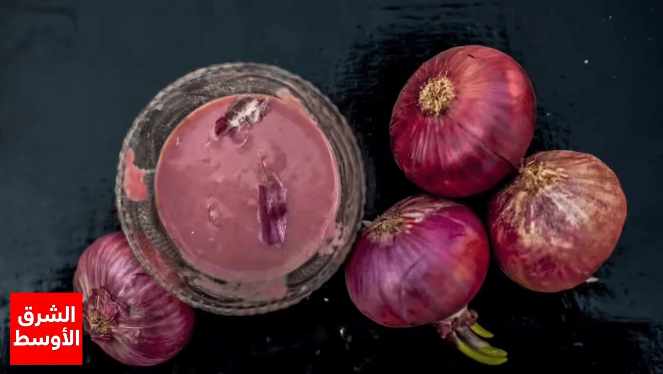 كيفية استخدام البصل وقشره لدعم صحة البروستاتا ووظيفة المثانة بشكل طبيعي