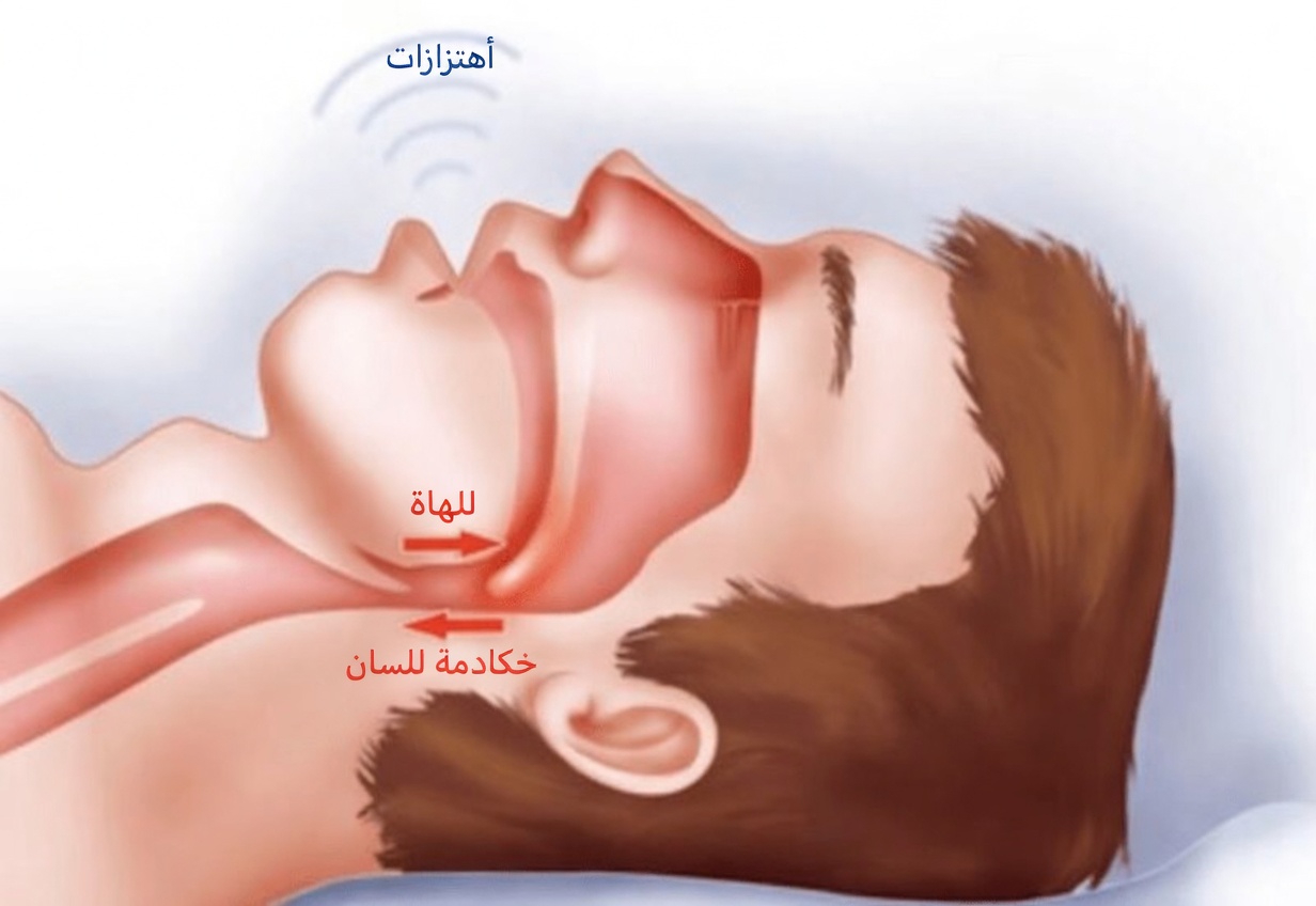 الاستيقاظ كل صباح على وسادة مبللة؟ 8 أسباب شائعة لسيلان اللعاب أثناء النوم يجب أن تعرفها