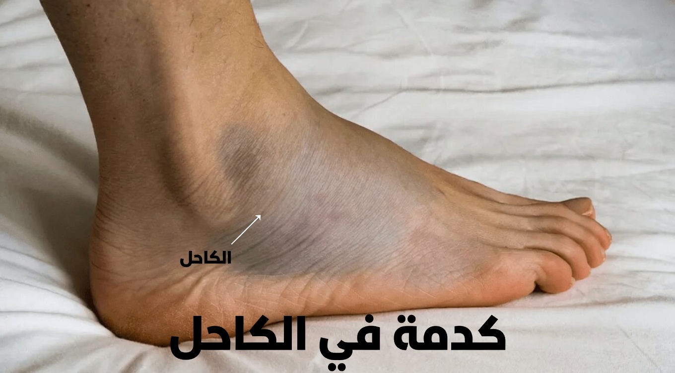 إليك 10 آثار جانبية شائعة لأملوديبين ينبغي أن تعرفها وكيفية التعامل معها