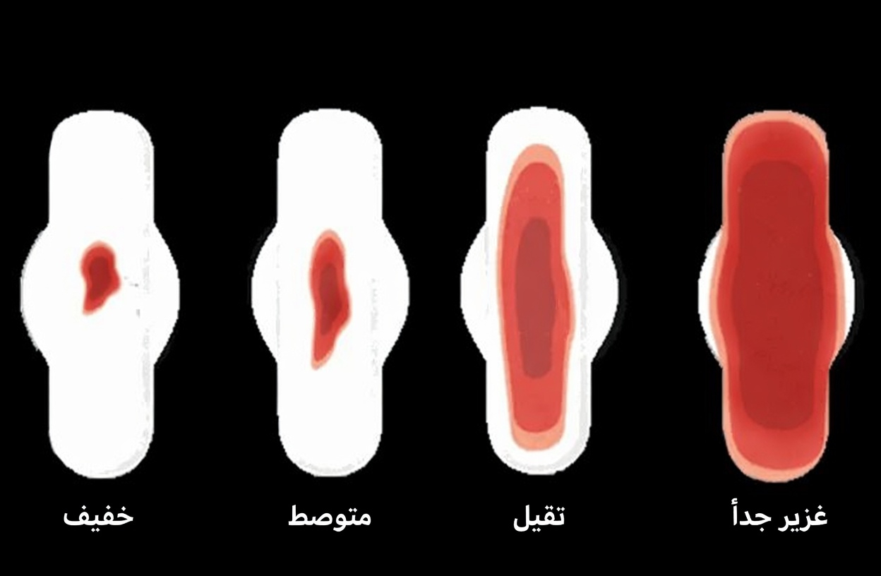 9 علامات إنذار مبكرة لسرطان عنق الرحم تفوتها معظم النساء وكيفية التعرّف عليها