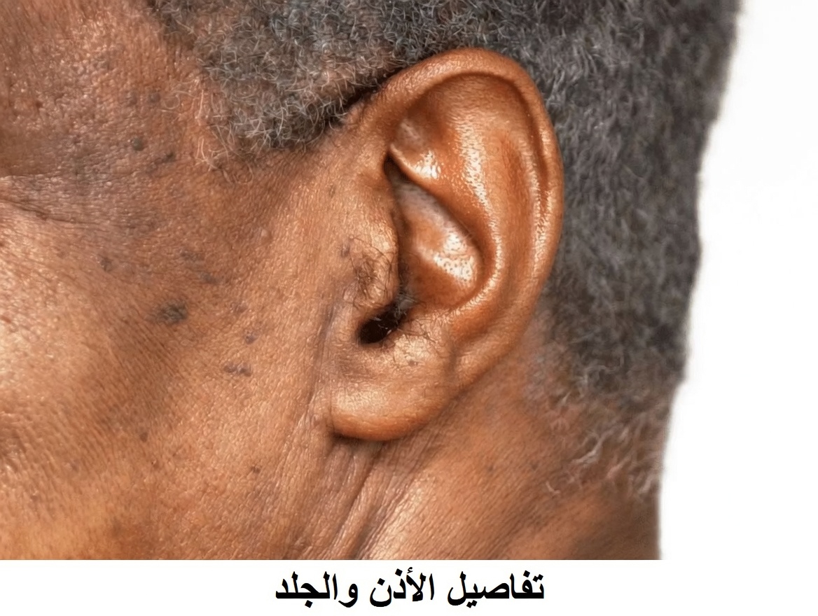 لماذا يزداد ظهور شعر الأذن مع التقدم في العمر – وما الذي يمكنك فعله حيال ذلك