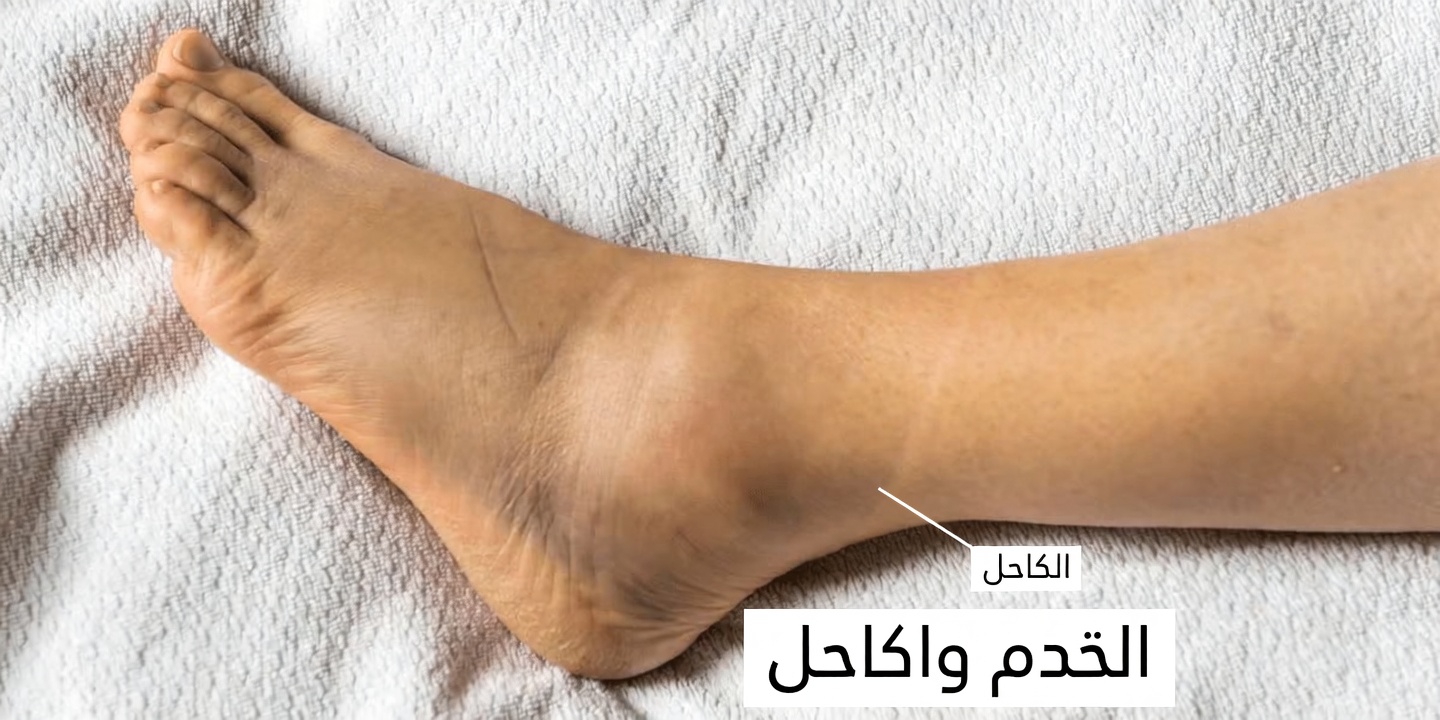 5 علامات تحذيرية صامتة تدل على أن قلبك في خطر شديد يجب على كل بالغ معرفتها الآن