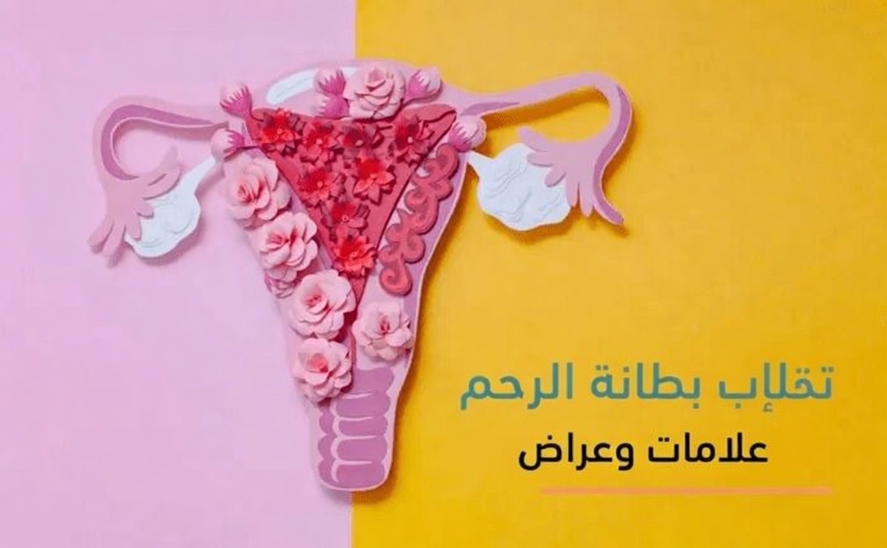 ما الذي يجب أن تعرفه كل امرأة عن الانتباذ البطاني الرحمي: الأعراض، والحقائق، والنصائح اليومية العملية