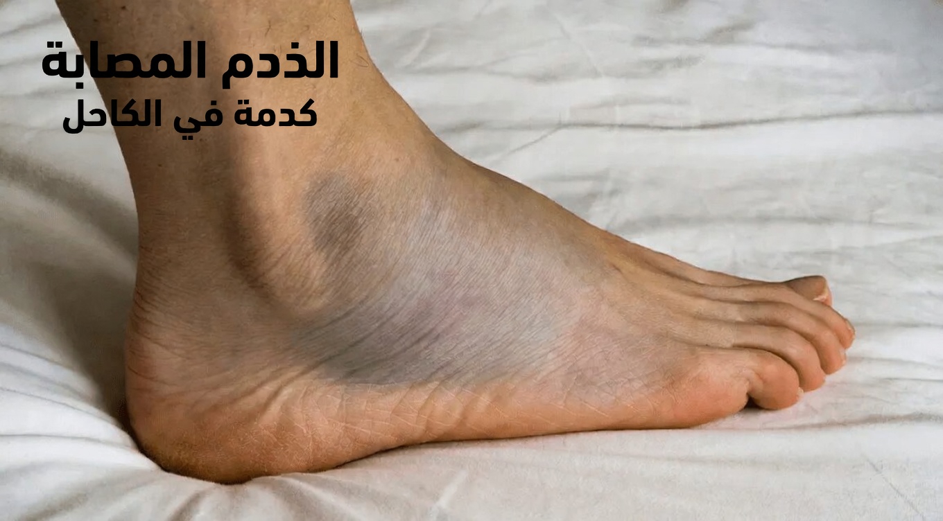 10 آثار جانبية شائعة لأملوديبين يجب أن تعرفها إذا كنت تتناول هذا الدواء الشائع لعلاج ارتفاع ضغط الدم