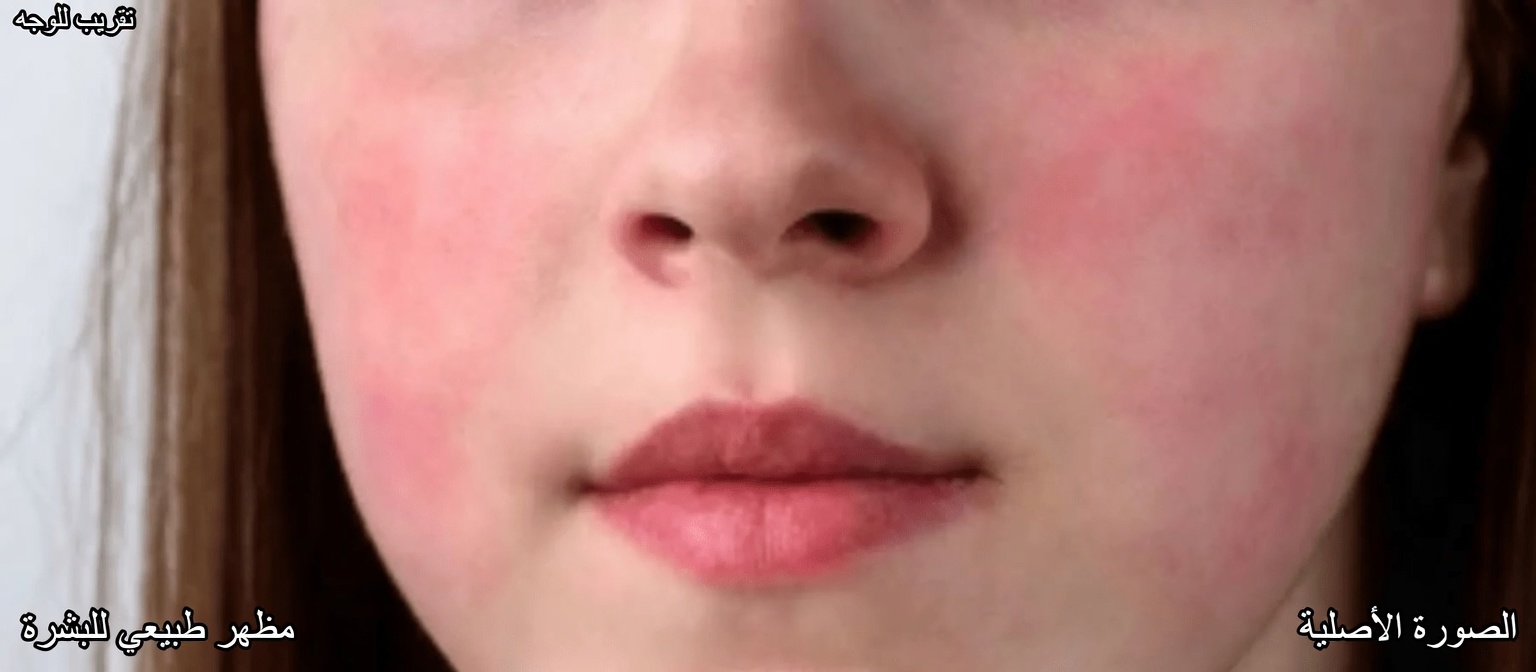 12 من الآثار الجانبية الشائعة لأملوديبين التي يجب أن تعرفها وكيفية التعامل معها بأمان