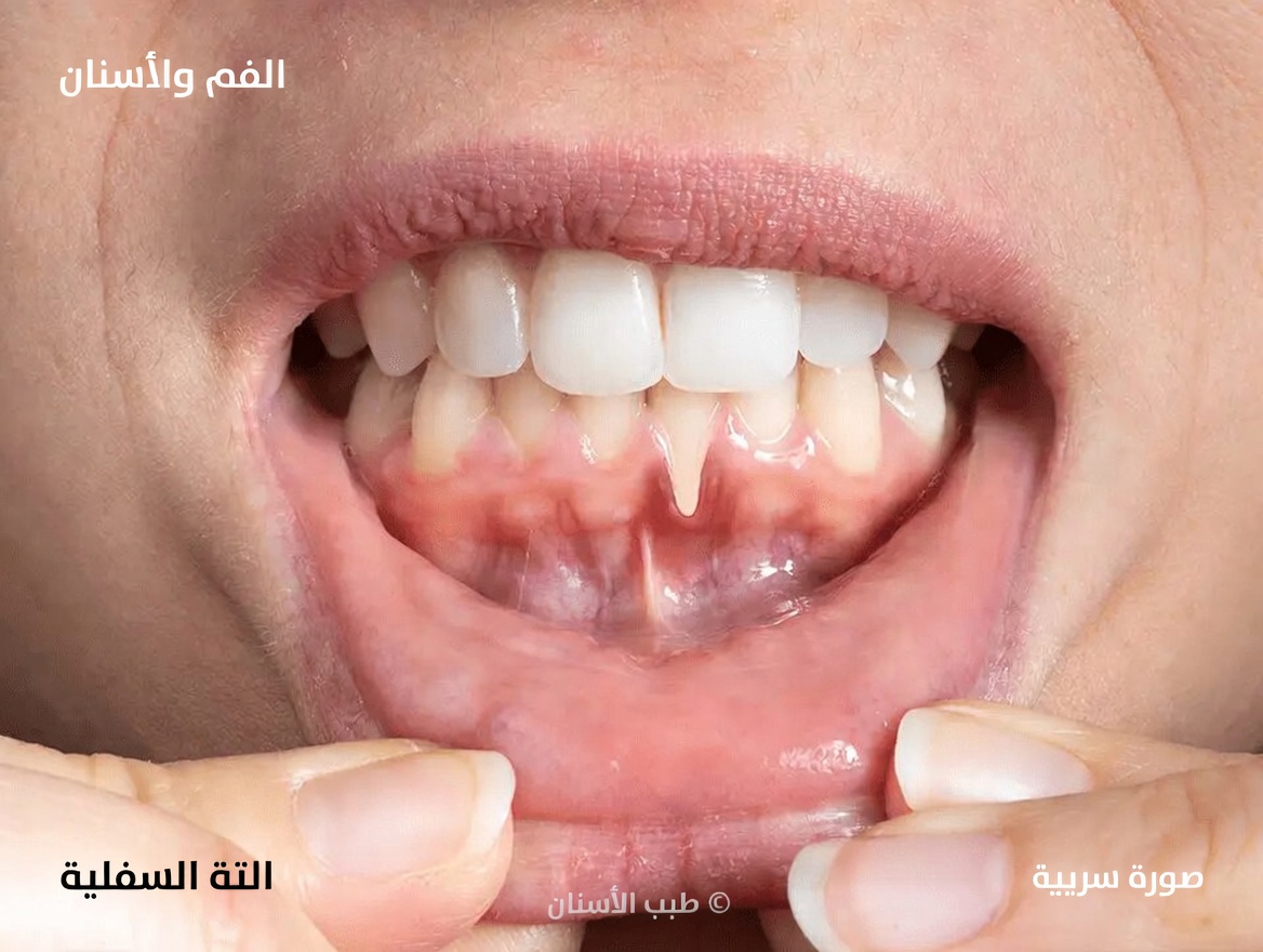 12 من الآثار الجانبية الشائعة لأملوديبين التي يجب أن تعرفها وكيفية التعامل معها بأمان