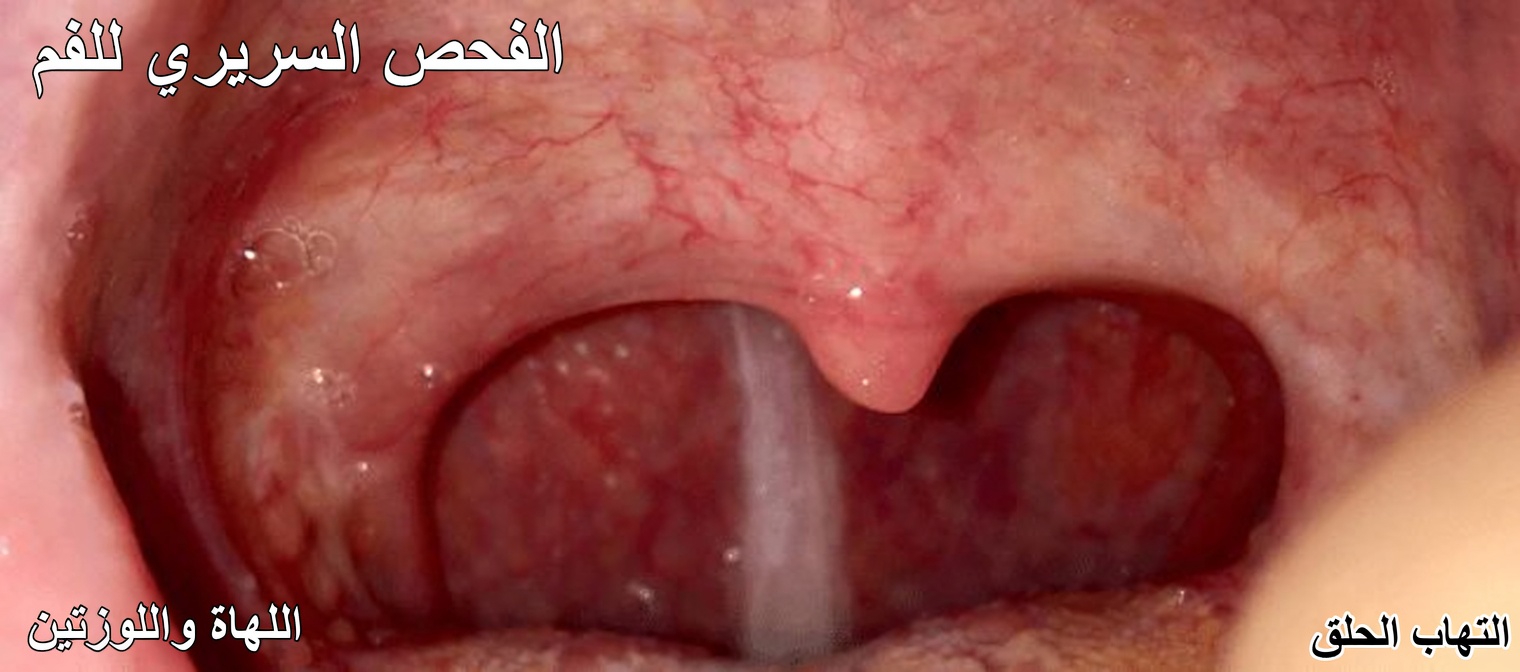 لماذا لديك بلغم مستمر في حلقك؟ العادة الخفية التي تجعله أسوأ من دون أن تدري