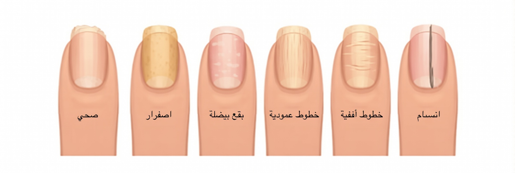 كيف يمكن لأظافر يديك أن تكشف ما يحدث داخل جسمك