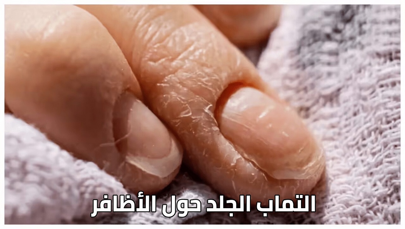 كيف يمكن لأظافر يديك أن تكشف ما يحدث داخل جسمك