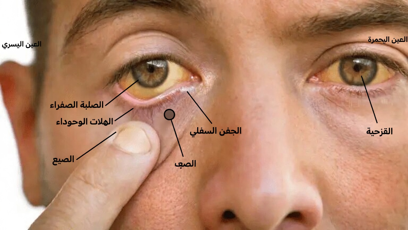 8 علامات غريبة يرسلها جسمك متوسلًا لفيتامين ب12 يجب أن تتعرف عليها فورًا