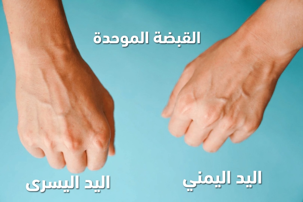 اكتشف سبب بروز أوردة يديك أكثر والعادات اليومية العملية التي ينبغي مراعاتها