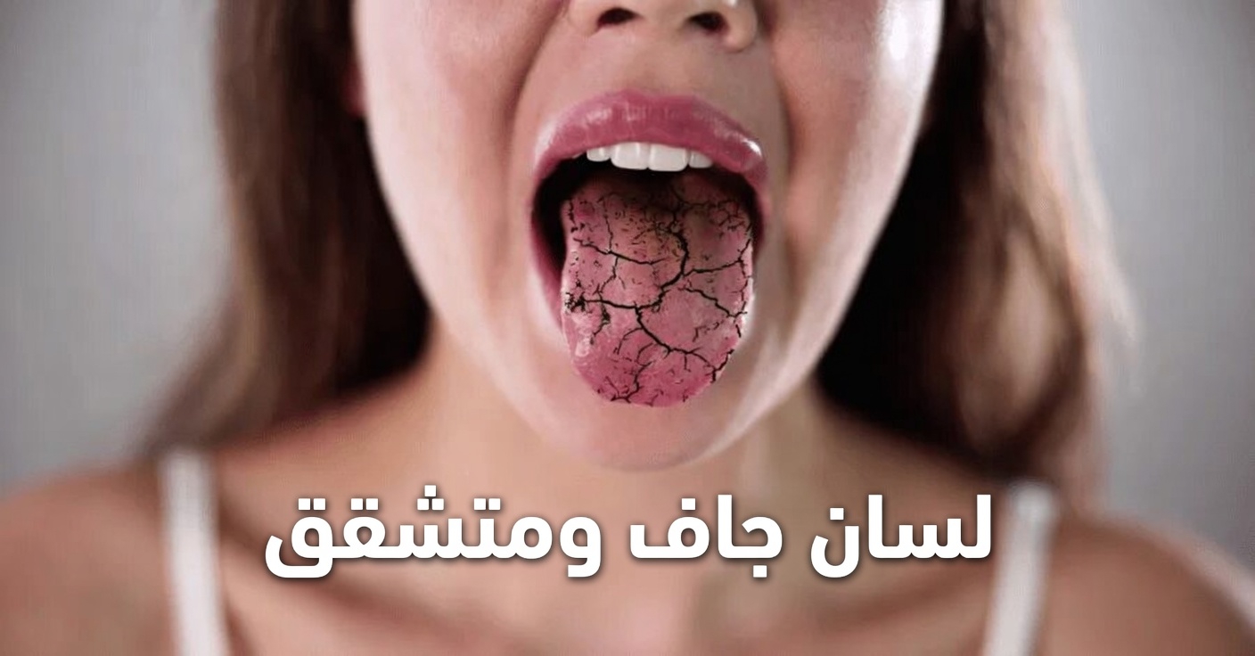 اكتشف 7 علامات غريبة قد تدل على أن كليتيك تطلبان المساعدة بصمت ويتجاهلها معظم الناس