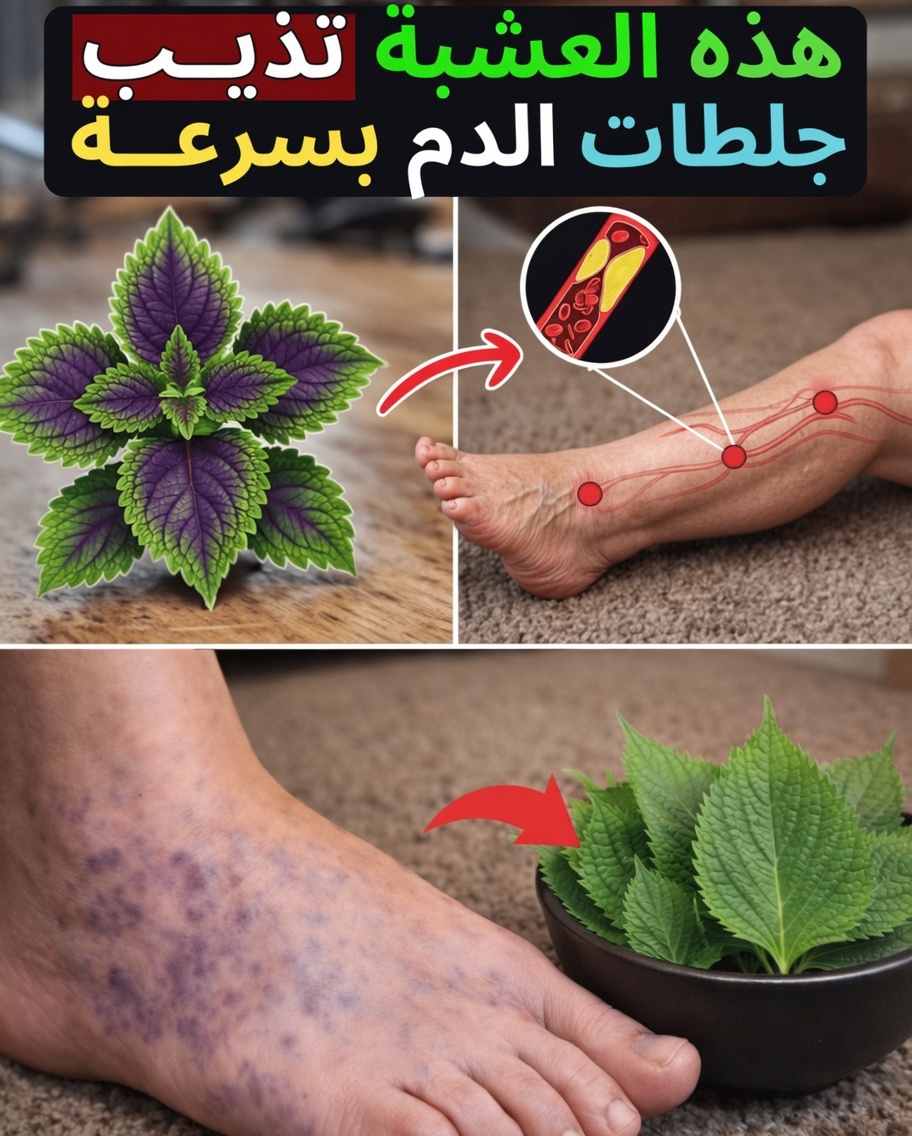 6 أعشاب قوية قد تساعد في دعم الدورة الدموية الصحية وتقليل خطر تجلط الدم بشكل طبيعي