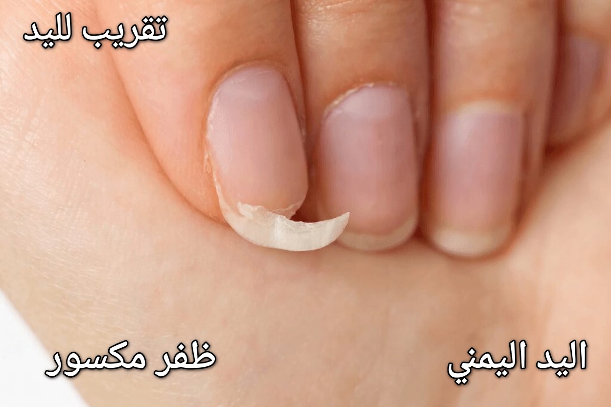 هل أظافرك تتشقق أو تنكسر دائمًا؟ إليك ما قد يحاول جسمك إخبارك به