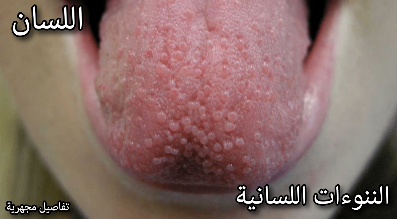 8 علامات تدل على أن جسمك يصرخ طلبًا للمساعدة وطرق سهلة لدعمه طبيعيًا