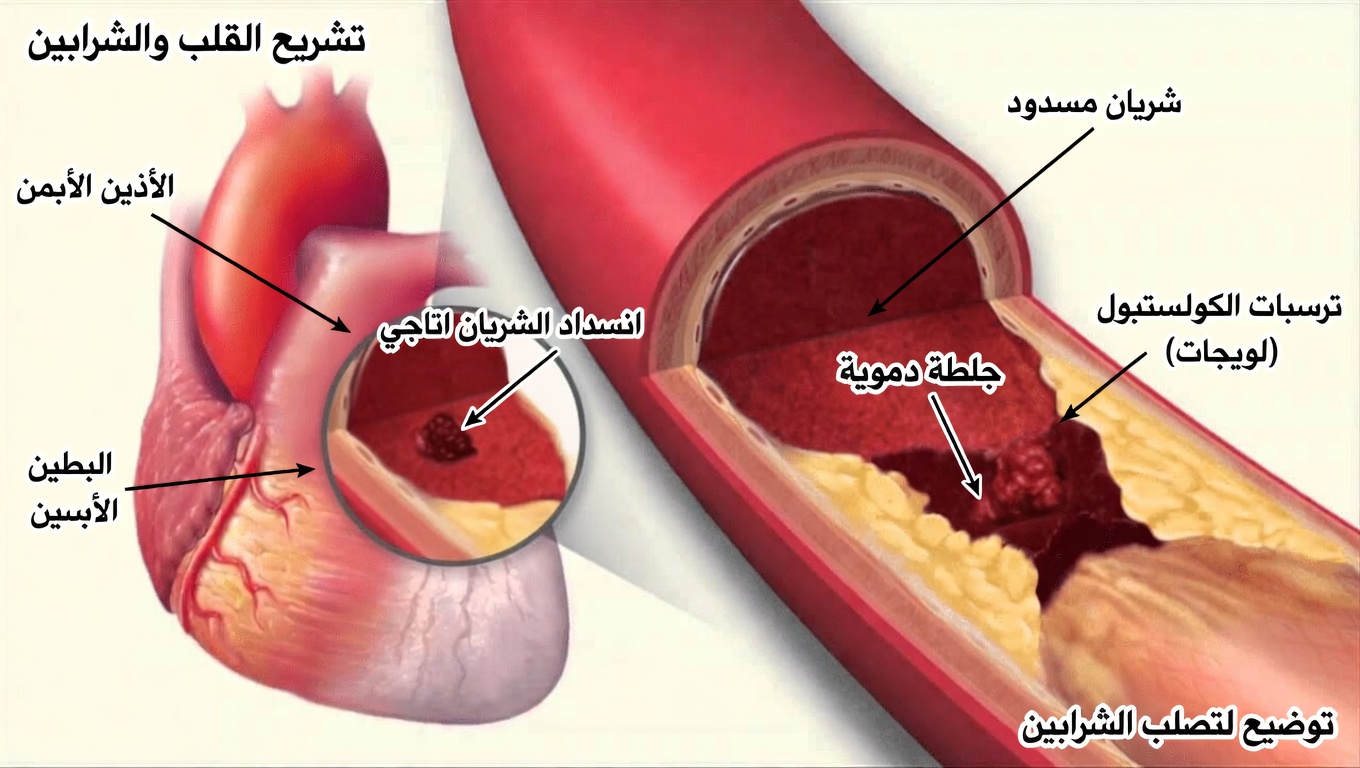 طبيب قلب يحذّر: هذا الدواء يضرّ بقلوب كبار السن! | نصائح صحية لكبار السن