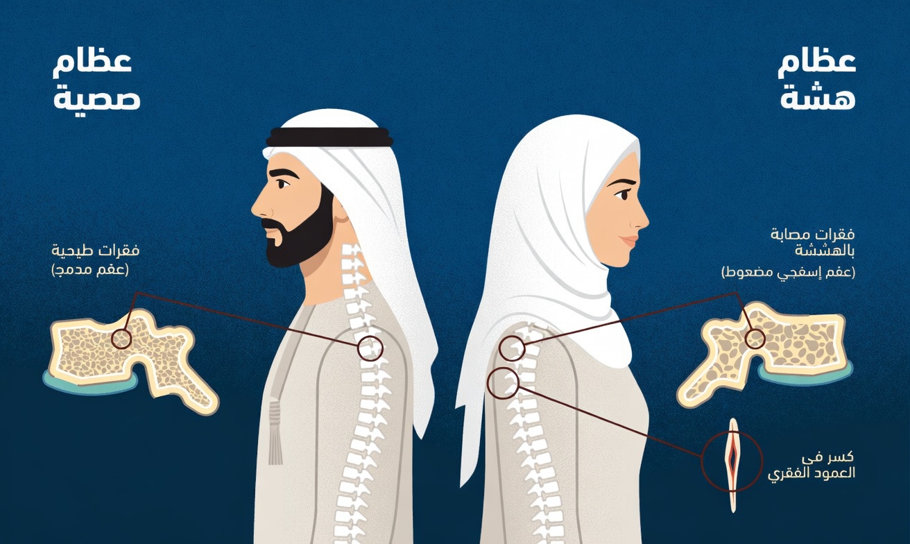 العمود الفقري السليم وهشاشة العظام: عادات يومية بسيطة لدعم عظام قوية ووضعية أفضل
