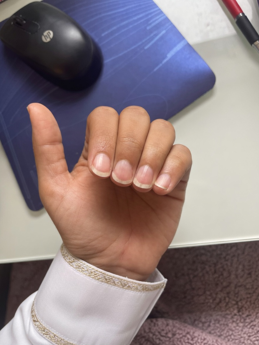 لماذا تظهر خطوط على أظافرك؟ ماذا قد تكشف عن صحتك