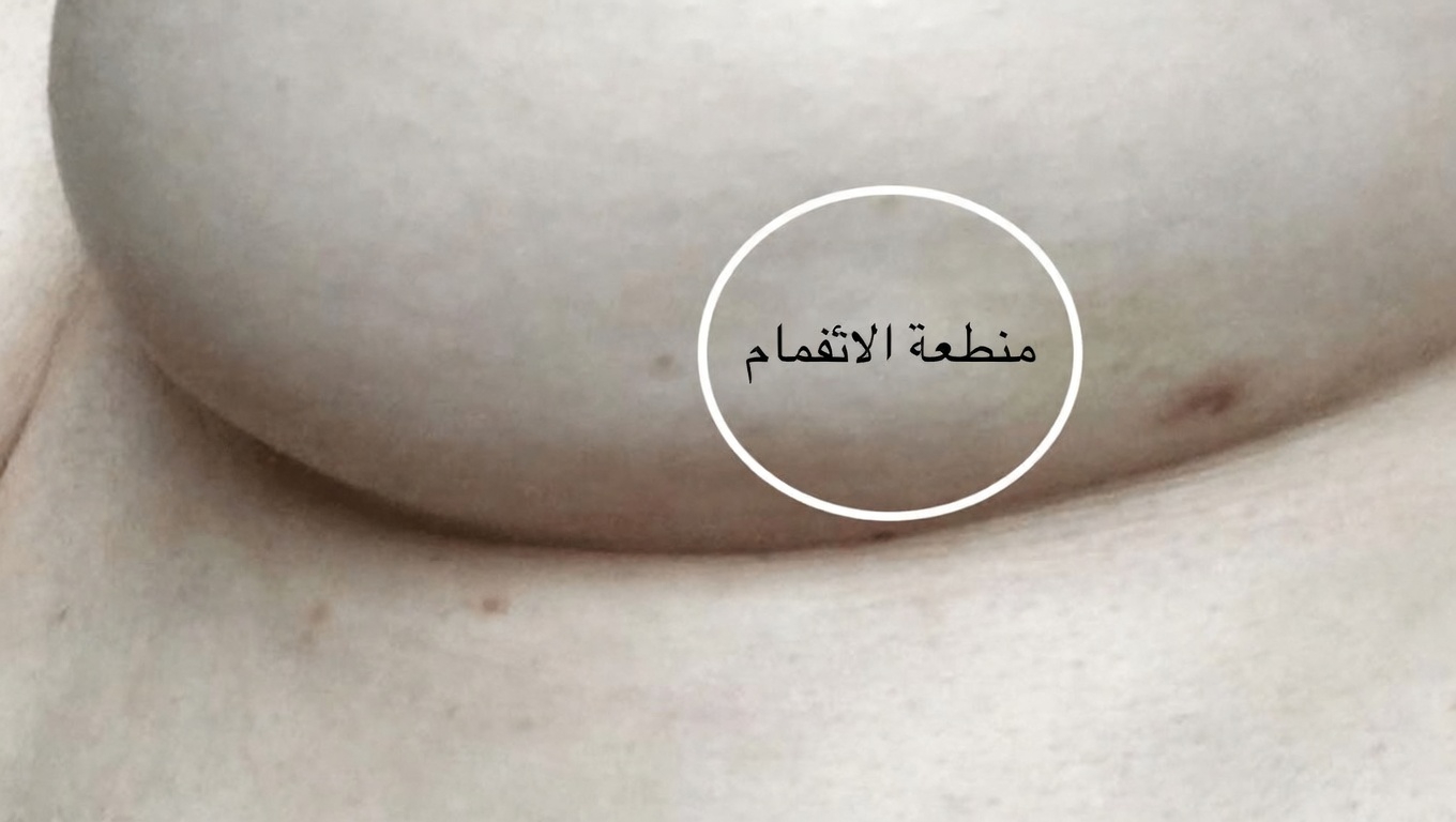 14 علامة مرئية للسرطان تتجاهلها معظم النساء وما يجب على كل امرأة معرفته عنها