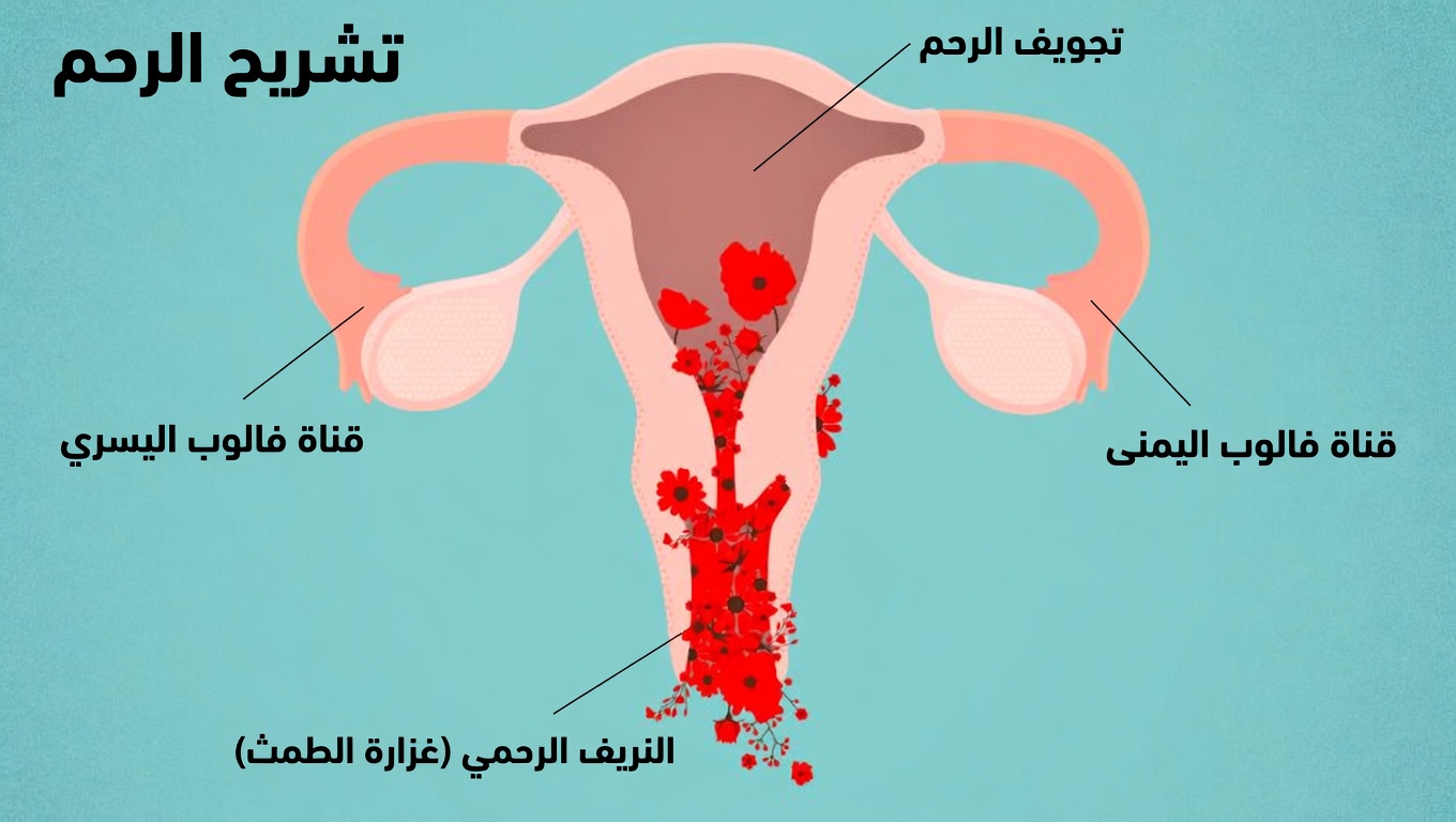 9 علامات مبكرة لسرطان عنق الرحم تتجاهلها معظم النساء: ما يجب على كل امرأة معرفته