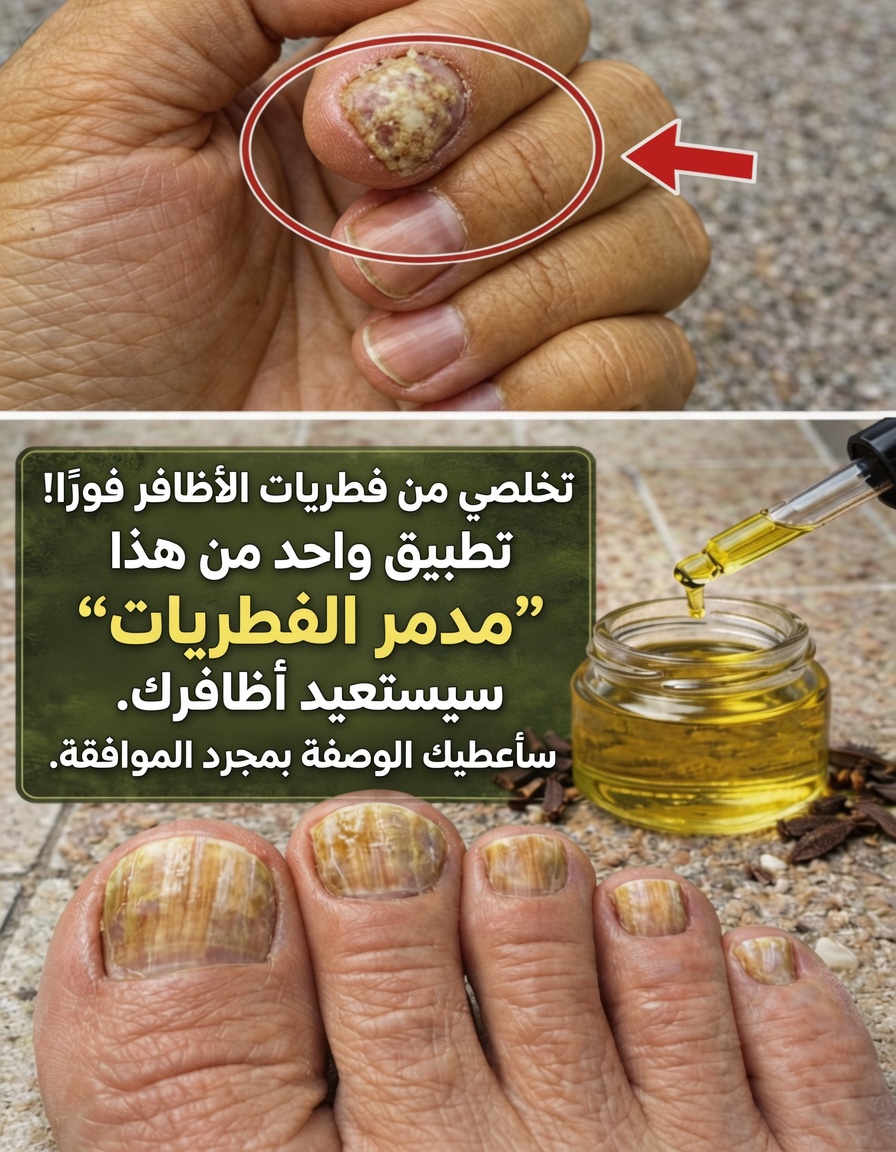 اكتشف لماذا يحظى القرنفل باهتمام متزايد لدعم صحة الأظافر: وصفات بسيطة وفوائد وعادات يومية مشروحة