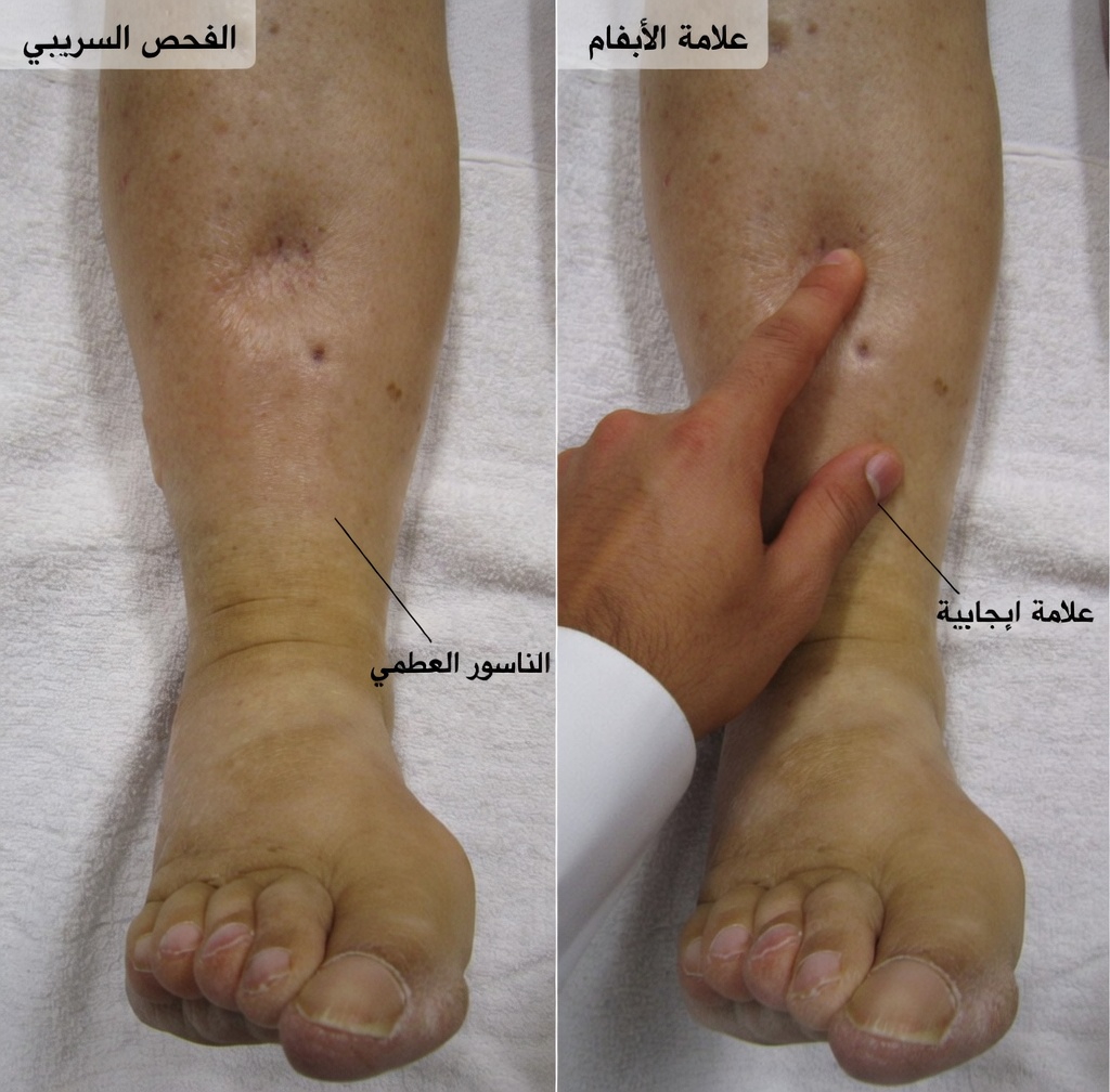 اكتشف 12 من الآثار الجانبية لأملوديبين التي ينبغي أن تعرفها ونصائح عملية للتعامل معها