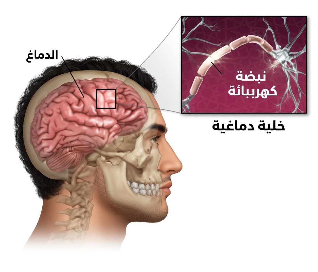 اكتشف هذه العلامات التحذيرية المبكرة العشر المرتبطة بأورام الدماغ ومتى ينبغي استشارة مختص