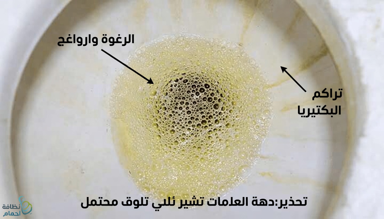 تعرّف على 17 علامة تحذيرية مهمة لمرض الكلى قد تظهر على جسمك يجب الانتباه إليها