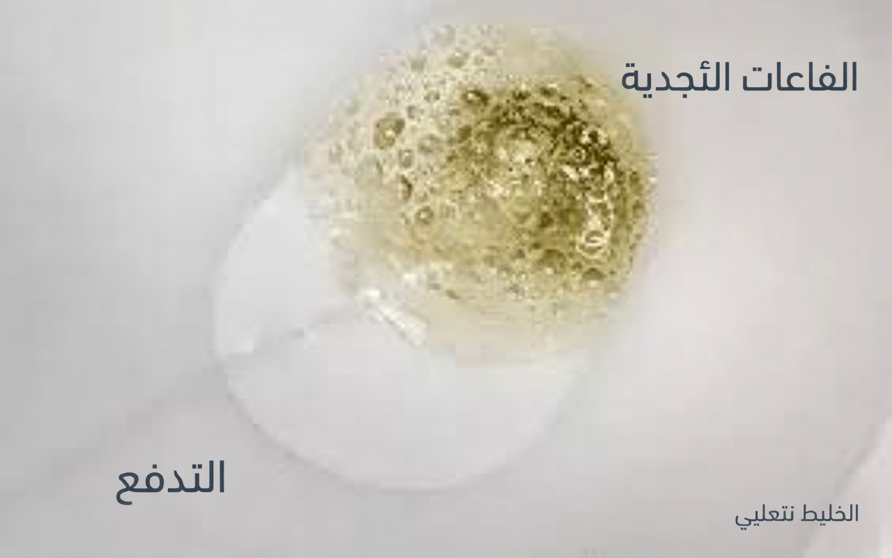 هل يتسرّب البروتين إلى بولك؟ 7 أطعمة واستراتيجيات علاجية فعّالة قد تدعم كليتيك بدءًا من اليوم