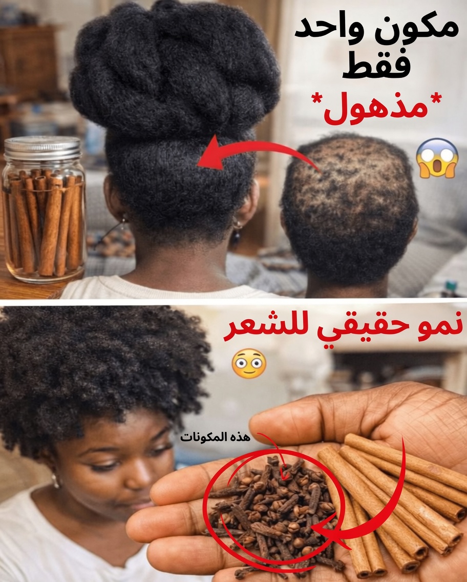 القرنفل والقرفة: السر الحار لشعر أكثر كثافة وأسرع نموًا