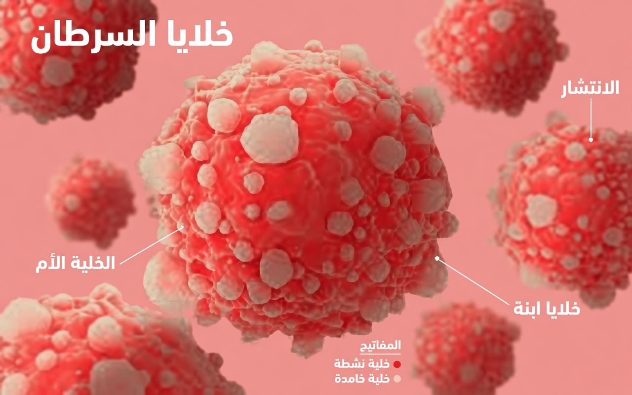 10 علامات لسرطان البنكرياس يجب ألا تتجاهلها أبدًا