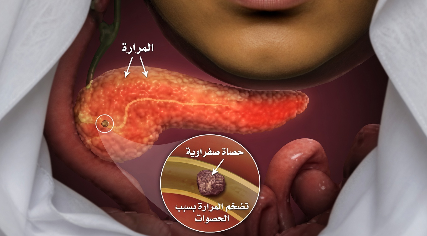 10 علامات لسرطان البنكرياس يجب ألا تتجاهلها أبدًا