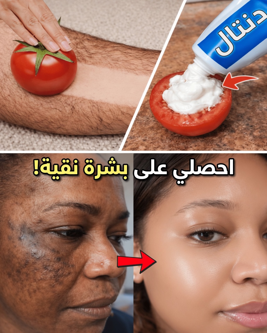 اكتشفي قناع الوجه الرائج من معجون الأسنان والطماطم الذي يجربه الكثيرون للحصول على مظهر مسام أصغر، وبقع داكنة أقل وضوحًا، وبشرة أكثر إشراقًا، وتقليل ألطف لشعر الوجه