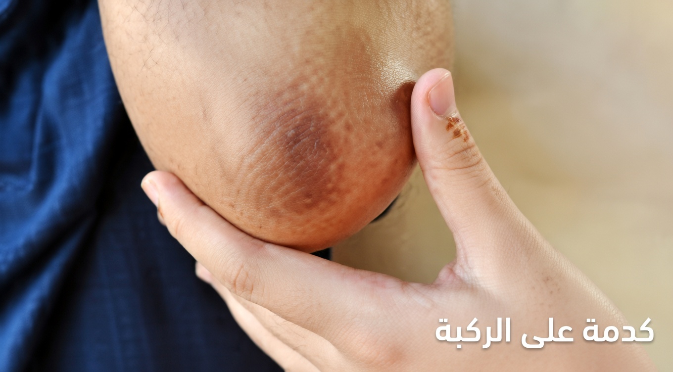 كيف يمكنكِ تفتيح المرفقين والركبتين والإبطين الداكنة بلطف باستخدام روتين بسيط بالليمون في المنزل؟