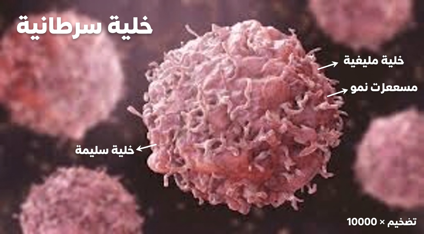 إليك 10 علامات شائعة ومهملة للسرطان يغفل عنها كثير من البالغين كل يوم