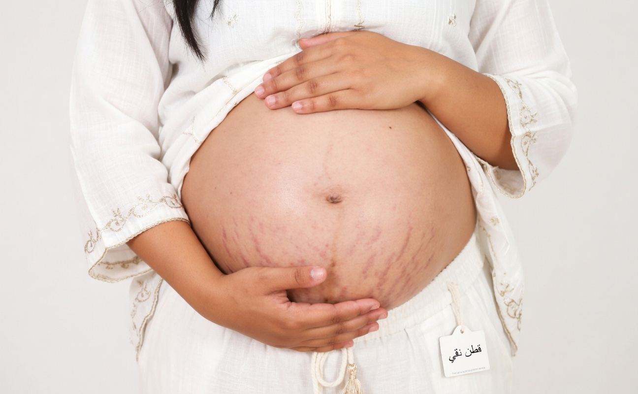كيفية دعم بشرتك أثناء الحمل وتغيرات الحياة: عادات بسيطة تساعد على تقليل ظهور علامات التمدد