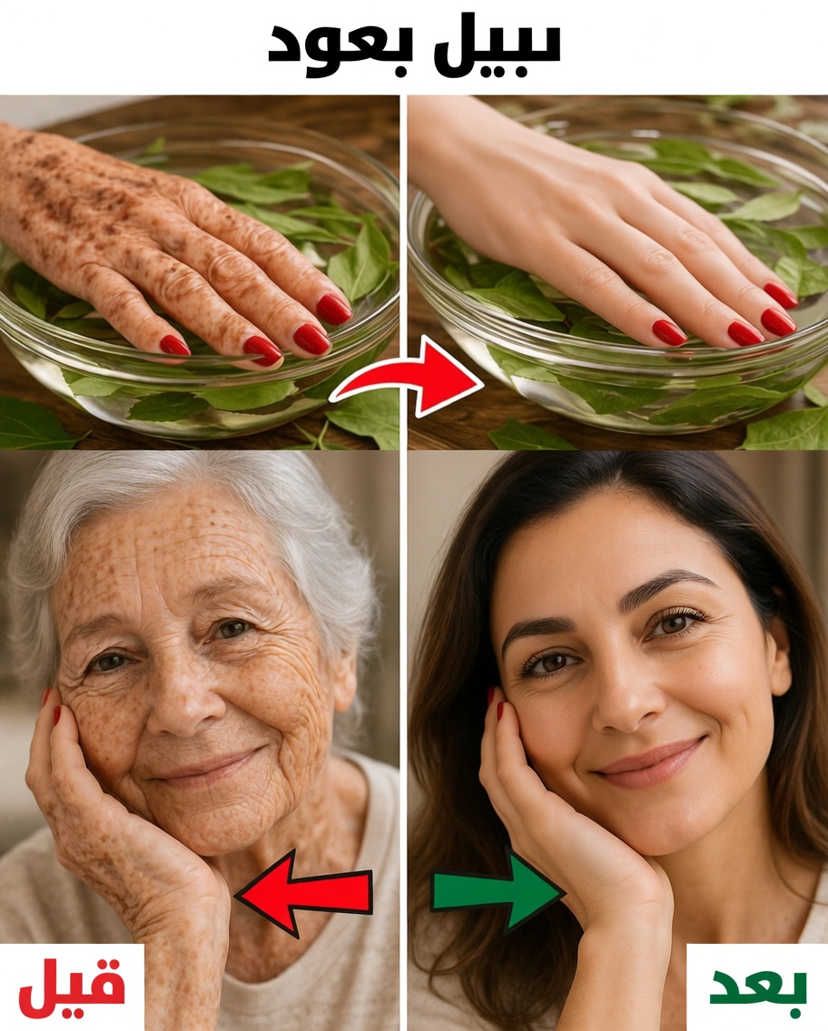 ورق الغار للتجاعيد: حقيقة أم خيال – استكشاف طرق طبيعية لدعم مظهر البشرة الشابّة