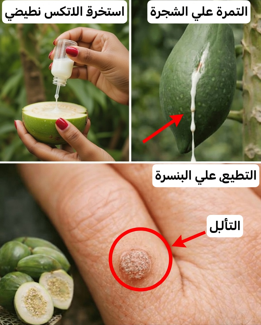 اكتشف 9 فوائد خفية للعصارة اللبنية للبابايا تفوتك من أجل صحة يومية أفضل