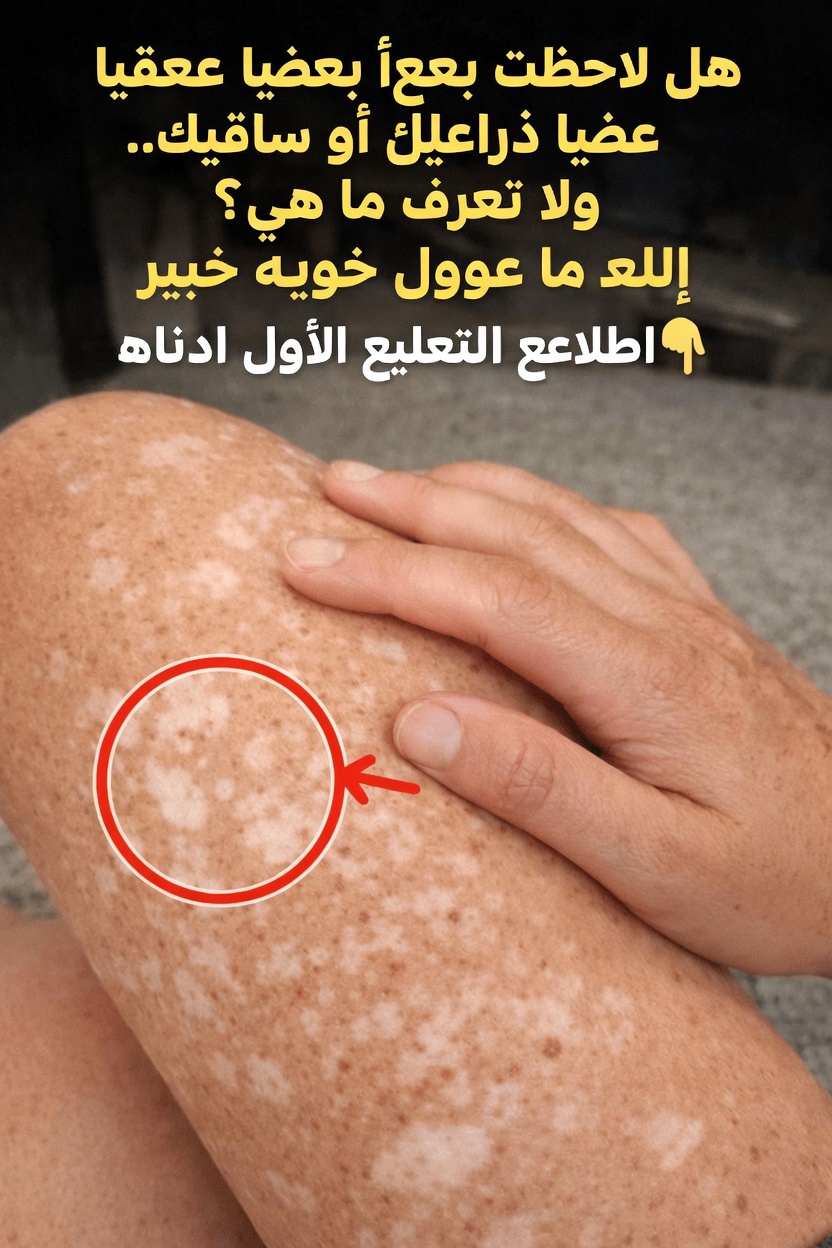 لماذا تظهر بقع بيضاء على بشرتك: أسباب شائعة تستحق المعرفة