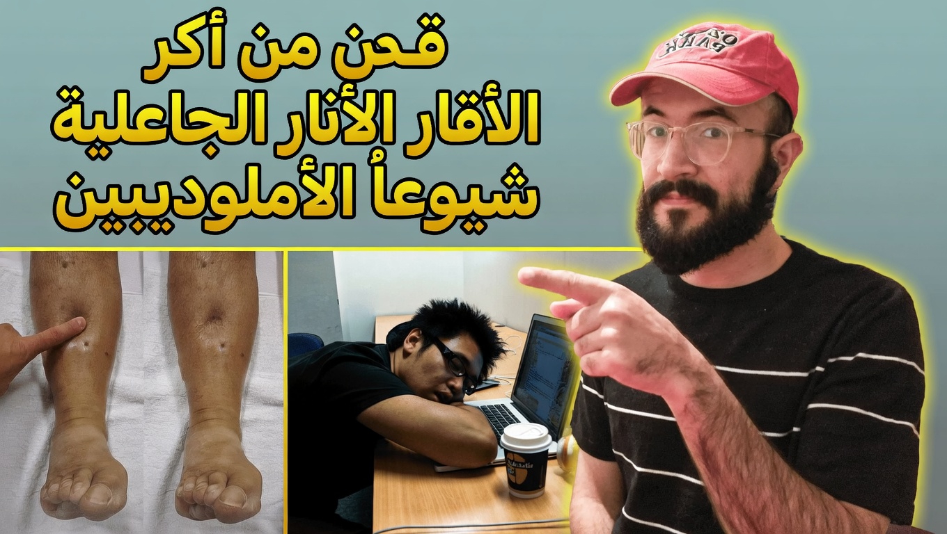 أكثر 12 من الآثار الجانبية شيوعًا لأملوديبين ولماذا تحدث لكثير من الناس