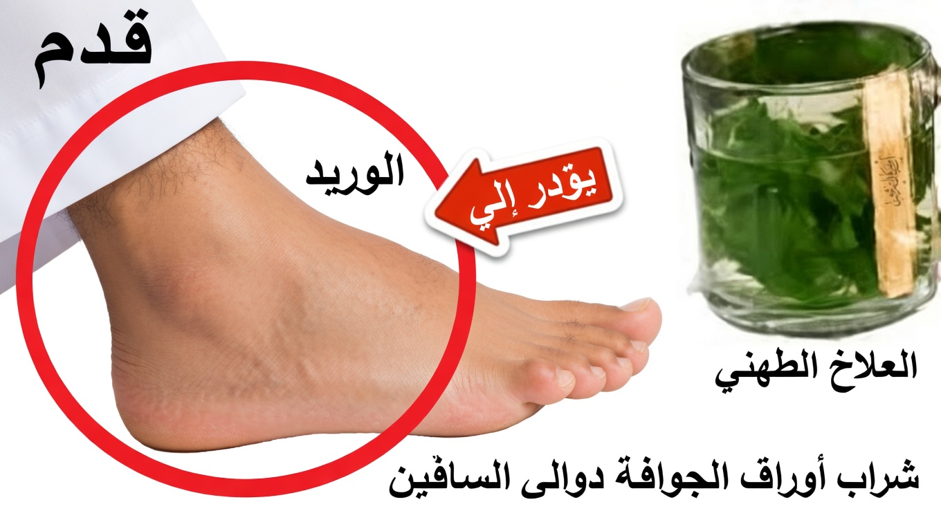 هل تُثقل عليك الساقان المتورمتان؟ قد يكون شاي البقدونس هذا هو الدعم اليومي الذي كنت تبحث عنه