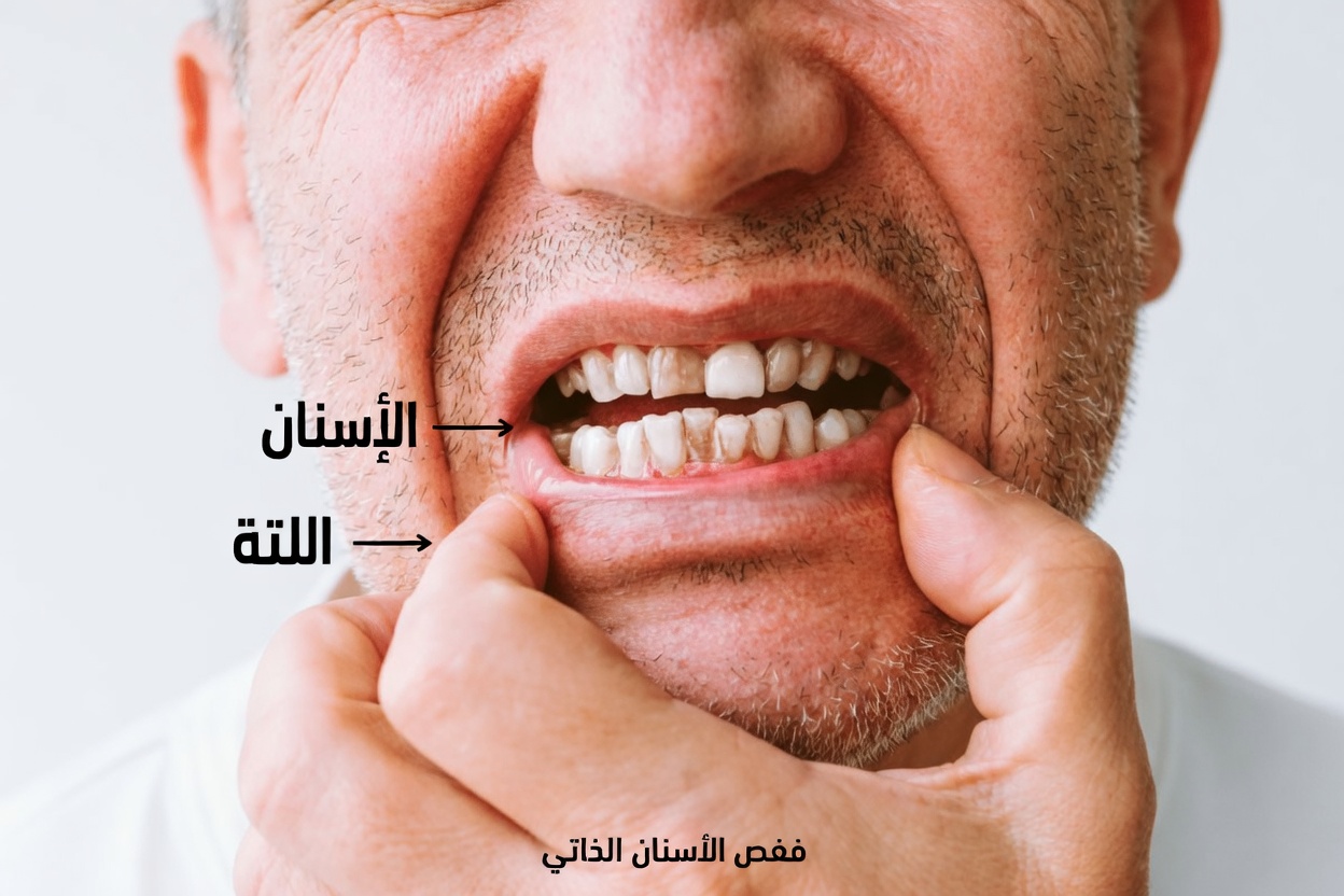 10 آثار جانبية للميتفورمين لا يتوقع كثير من المرضى ملاحظتها بعد سنوات من الاستخدام اليومي