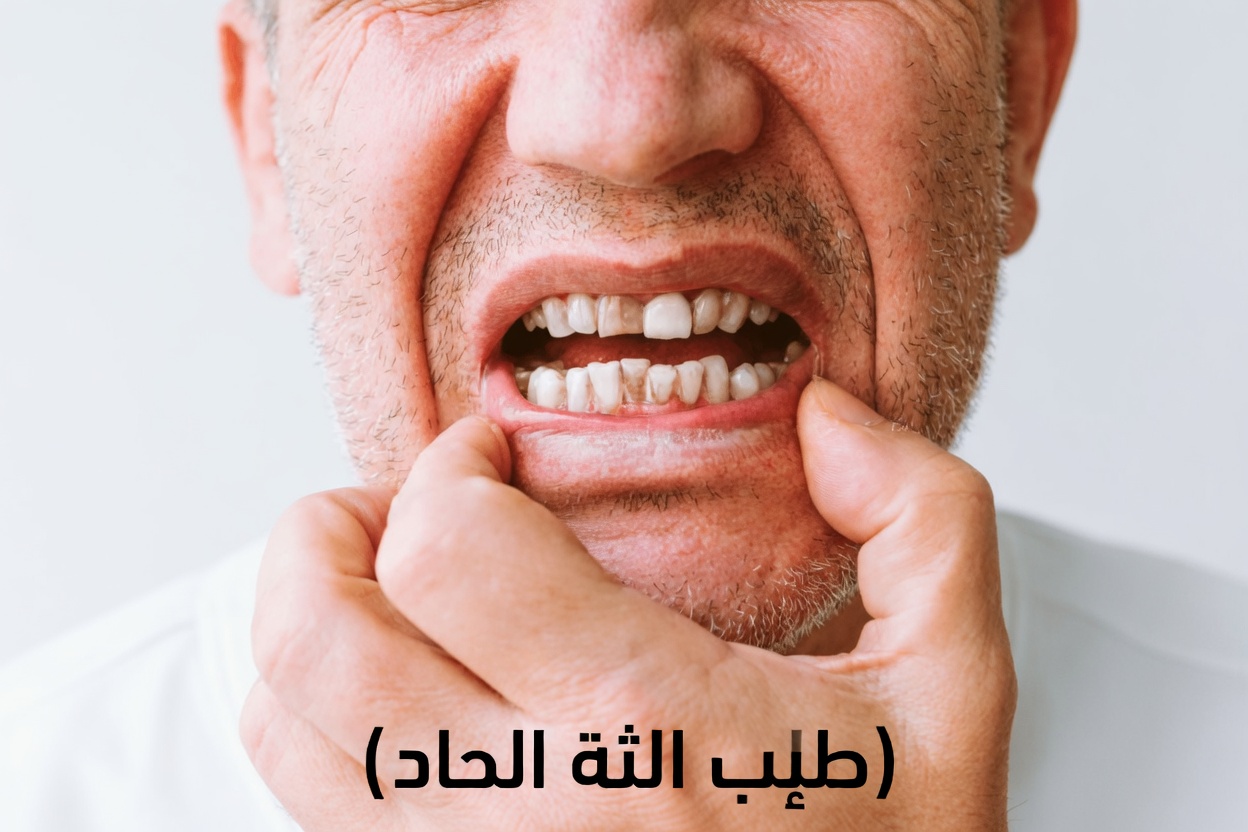 10 آثار جانبية للميتفورمين لا يتوقع كثير من المرضى ملاحظتها بعد سنوات من الاستخدام اليومي