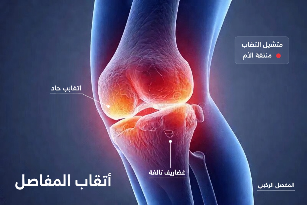 لم تستطع والدتي المشي بسبب آلام العظام والركبة – الوصفة اليومية البسيطة التي دعمت حركتها