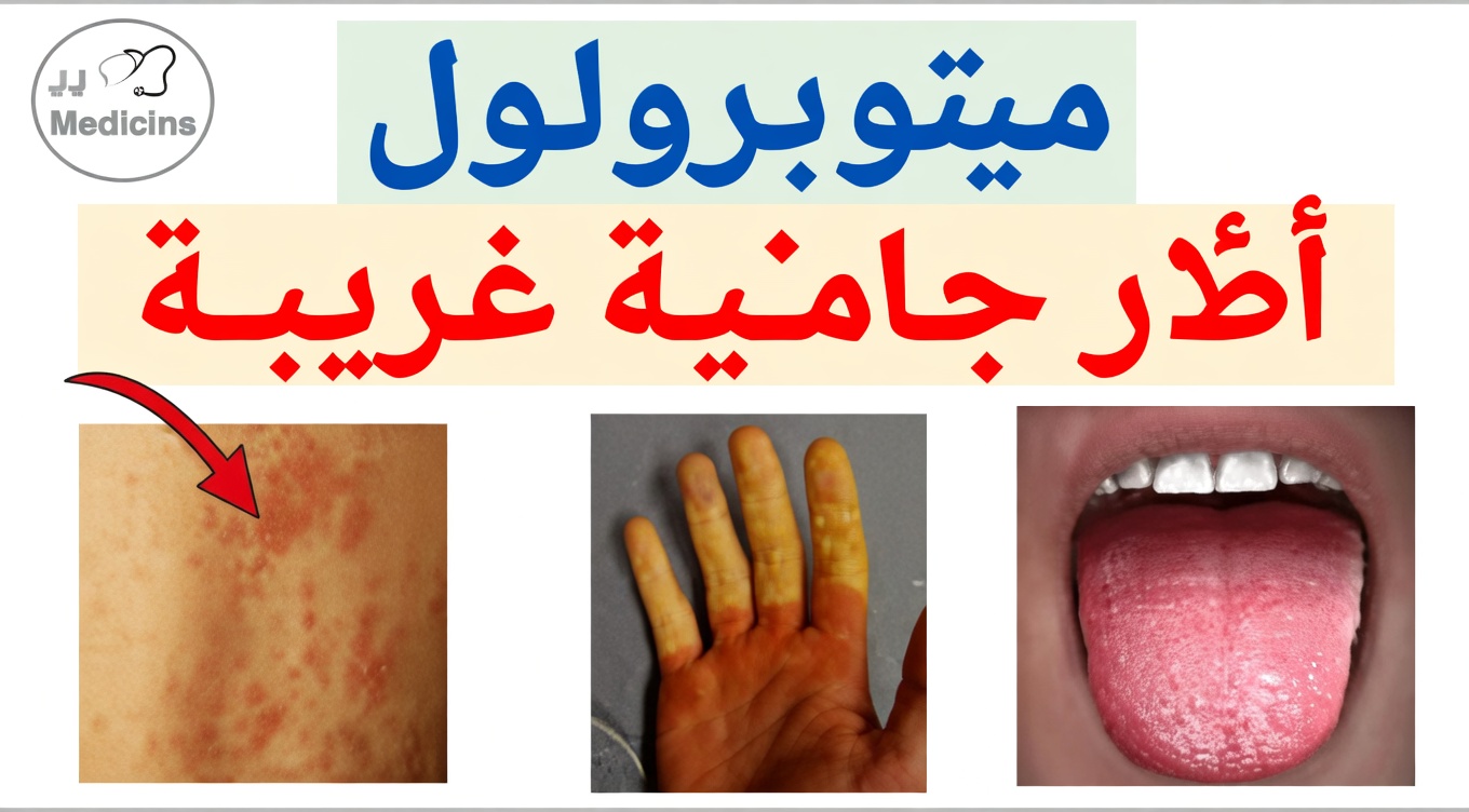 الآثار الجانبية العشر للميتوبرولول التي يُصلي طبيبك ألا تكتشفها