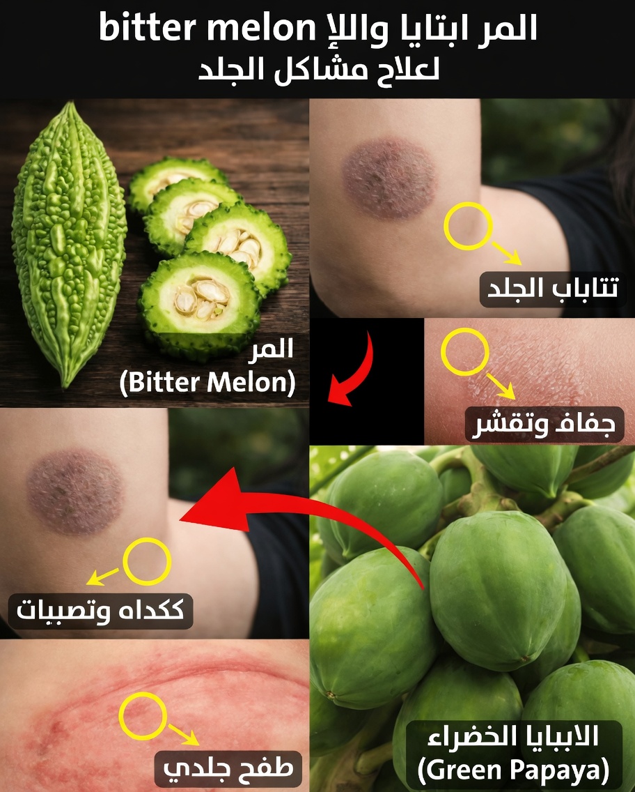 ٩ علاجات منزلية طبيعية للعدوى الفطرية: نصائح يومية بسيطة لدعم راحة البشرة وعافيتها