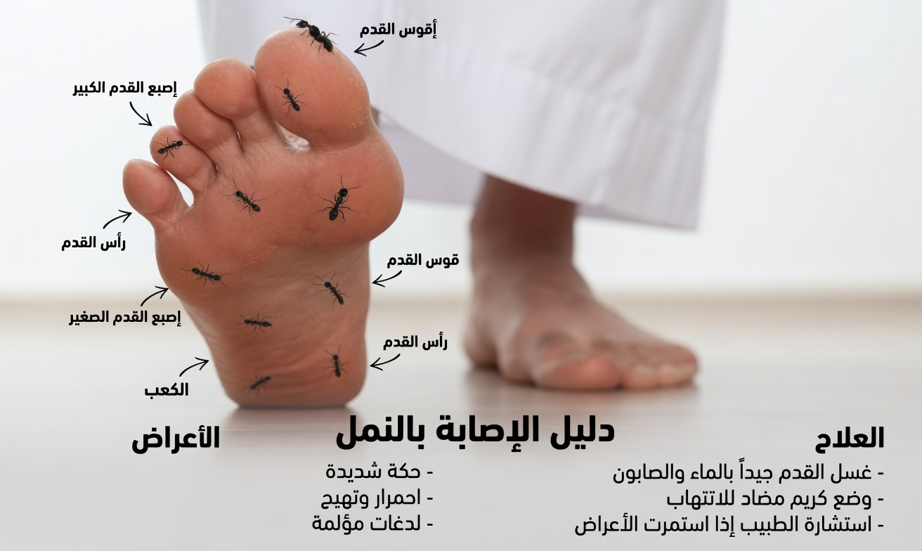 هل ترسل ساقاك إشارات تحذيرية قبل الإصابة بالسكتة الدماغية؟ علامات يتجاهلها كثير من كبار السن